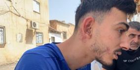 عائلة حوامدة: الشرطة اعتدت علينا بشكل وحشي