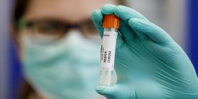 لندن تتهم موسكو بالسعي لسرقة لقاح لكورونا 