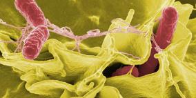 التسمم السجقي..حالة خطيرة ونادرة