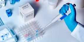 روسيا: بدء إنتاج لقاح ضد فيروس كورونا في نوفمبر المقبل