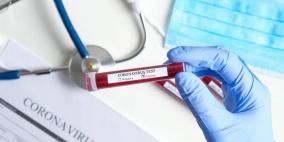 وفاة 3 فلسطينيين متأثرين بإصابتهم بكورونا في السعودية