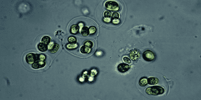 وباء تاريخي يحقق "عودة" مخيفة بسبب "استنساخ'' بكتيري!