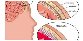 ما هي مضاعفات الحمى الشوكية؟