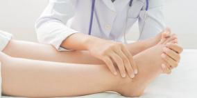 12 علاجاً منزلياً فعالاً لتورم القدمين