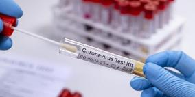 الصحة: 19 وفاة و660 إصابة جديدة بكورونا 