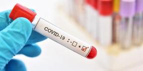 الصحة: 9 وفيات و513 إصابة جديدة بكورونا 