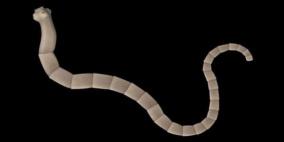 بالفيديو: استخراج دودة 18 متر من بطن شخص في تايلاند