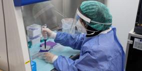 الصحة: 31 وفاة و 2025 إصابة جديدة بفيروس كورونا