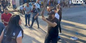 "مدى" يدين الاعتداءات ضد الصحفيين ويطالب بتوفير الحماية لهم