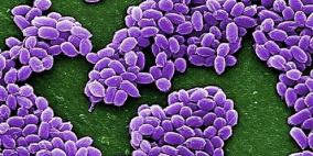 دولة أوروبية تسجل 5 حالات جديدة من "الجمرة الخبيثة"