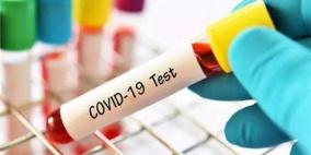 روسيا تسجل لقاحا رابعا ضد فيروس كورونا