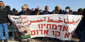 النقب: إصابات واعتقالات واستهداف للصحفيين في قمع وحشي