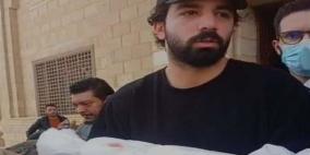 بعد جراحة دقيقة.. وفاة نجل فنان مصري