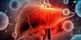 انتشر في 11 دولة.. ما هو التهاب الكبد الغامض الذي يهاجم الأطفال