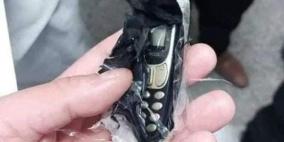 شاهد.. استخراج هاتف من بطن شاب مصري