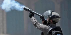 إصابات بالاختناق في صفوف العمال قرب جدار الفصل غرب جنين