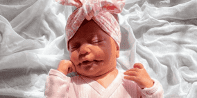 فيديو: مرض "الابتسامة الدائمة" النادر يحوّل طفلة إلى نجمة