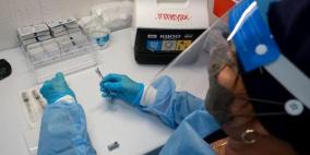 جدري القردة: تراجع كبير في عدد الإصابات لكن الوباء لم ينته