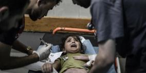 "آكشن إيد": العمليات الجراحية في مستشفى العودة تجرى بمصابيح الرأس في ظل انقطاع الكهرباء