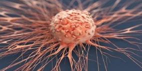 السرطان في 2024.. هذه الأورام الأكثر شيوعا وفتكا