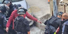 إصابة في الرأس خلال مواجهات مع الاحتلال في مخيم شعفاط