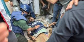 نقابة الصحفيين تدين بشدة استهداف الاحتلال بشكل مباشر الزملاء الصحفيين