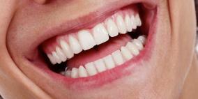 اكتشاف ارتباط بين فقدان الأسنان وزيادة خطر السمنة