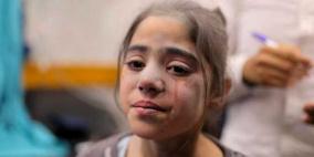 أخصائية نفسية لراية: علاقة الفلسطينيين مع البشرية "تغيرت"