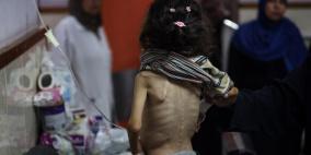 مسؤول صحي لراية: غزة على أعتاب كارثة كبرى شبيهة بـ"مجاعة أفريقيا"