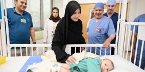 فصل التوأم الطفيلي المصري في السعودية: القصة كاملة بالفيديو والصور