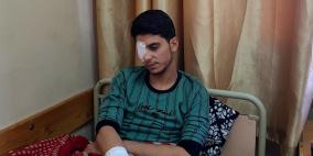 غزة: 1500 مواطن فقدوا البصر جراء حرب الإبادة و4000 مهددون بفقدانه