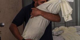 غزة: 326 وفاة بسبب سوء التغذية ونقص الدواء وأكثر من 300 حالة إجهاض