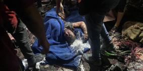 إستشهاد 21 مواطنا في غزة منذ فجر اليوم