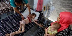 وفاة 5 مواطنين بينهم طفلان خلال الـ24 ساعة الماضية بسبب سوء التغذية والمجاعة