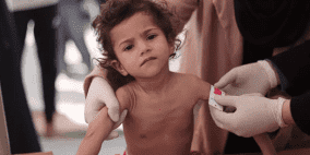  ارتفاع غير مسبوق بمعدلات سوء التغذية في غزة