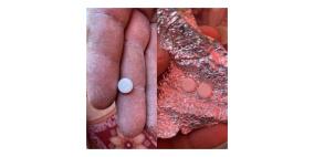 خاص| أقراص مخدّرة في مساعدات إنسانية موجهة لغزة.. دعوات لتحقيق دولي ومساءلة