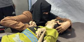 منعطف خطير بمسار الكارثة.. استشهاد شاب بسبب الجوع في غزة