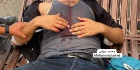 11 شهيدا بقصف الاحتلال مناطق متفرقة من مدينة غزة