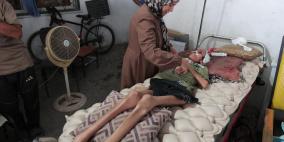 الدقران لراية: موجات من المواطنين المجوعين يصلون مستشفيات غزة بحالة إعياء تام