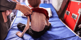 18 وفاة خلال 24 ساعة بسبب الجوع في غزة