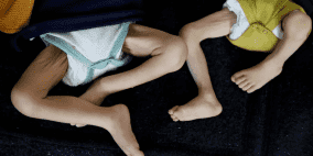 خلال 72 ساعة: وفاة 21 طفلا بسبب سوء التغذية والمجاعة في غزة