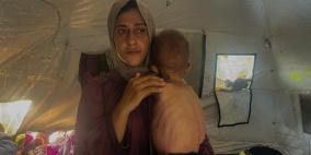 برنامج الأغذية العالمي يحذر من تفاقم أزمة الجوع في غزة