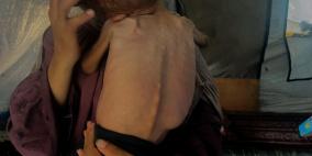 "أوتشا": 96% من الأسر في غزة تواجه انعدام الأمن المائي