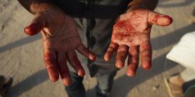 طبيب بريطاني: غزة تواجه همجية من العصور الوسطى