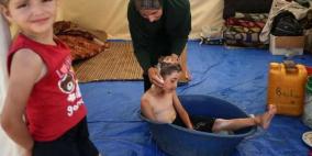 غزة تعاني نقصا حادا في مستلزمات النظافة والصابون بات نادرا