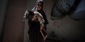 5 وفيات نتيجة التجويع في قطاع غزة خلال الـ24 ساعة الماضية