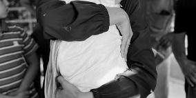 وفاة طفل في قطاع غزة نتيجة المجاعة وسوء التغذية