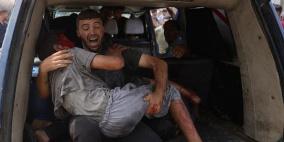 العدوان على غزة: شهداء وجرحى بعدة مناطق في القطاع
