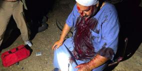 إصابة مواطن وزوجته جراء اعتداء من قبل المستوطنين بمسافر يطا