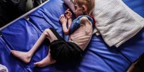 خاص| تهدئة بلا أمان: واقع طبي منهار يهدد حياة آلاف الأطفال في غزة